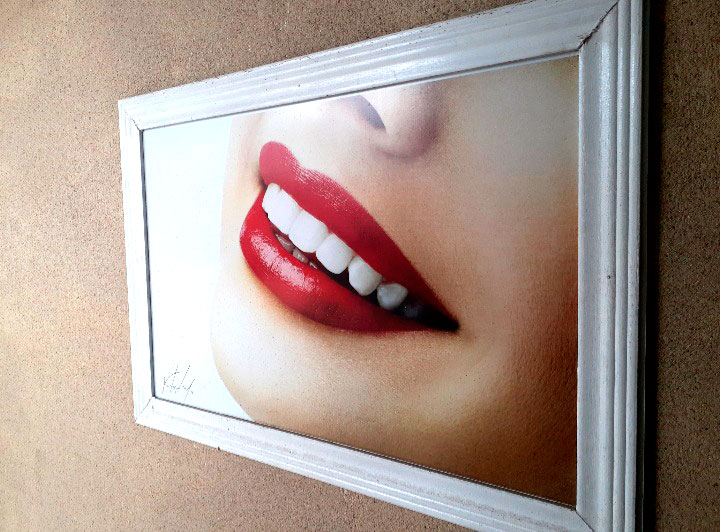 Lentes & Facetas Vip